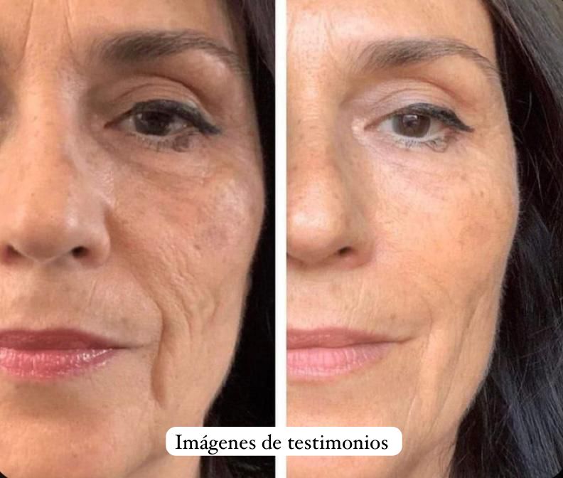 Elimina las ojeras y párpados caídos